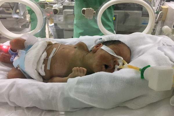 Bé Bình An nắm chặt tay bác sĩ, điều kỳ diệu đến với cả 2 mẹ con
