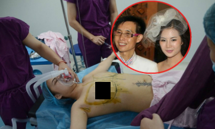 Lộ ảnh phẫu thuật ngực của vợ cũ đạo diễn Đặng Kiến Quốc
