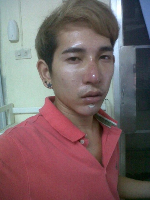 Chàng trai <b>Thái công</b> khai ảnh thẩm mỹ sau khi bị bạn gái bỏ rơi 0 - chang-trai-thai-1-ngoisao.vn
