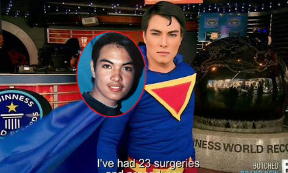 Chàng trai trải qua 23 ca phẫu thuật thẩm mỹ để trông giống siêu nhân