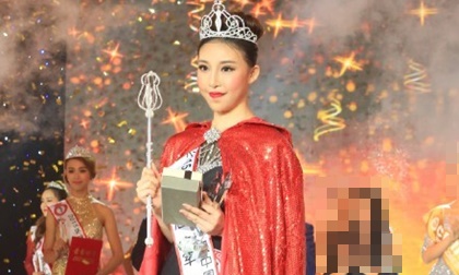 Hoa hậu Hoàn cầu Trung Quốc 2015 bị chê răng hô, mặt xấu