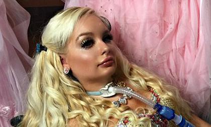 Cô gái khuyết tật chi hơn 300 triệu đồng để trông giống búp bê Barbie