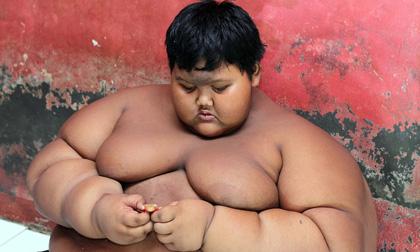 Bé 10 tuổi béo nhất thế giới nặng 192kg 