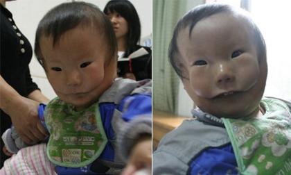 Con sinh ra có khuôn mặt dị dạng dù siêu âm đều đặn 