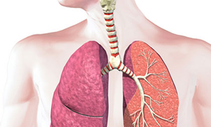 Dấu hiệu của ung thư phổi ở nam và nữ giới thường bị bỏ qua
