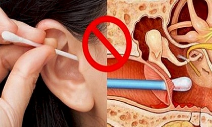 Nếu đang có thói quen sử dụng bông ngoái tai, bạn sẽ chết điếng vì những lý do sau