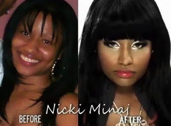 nicki-minaj-plastic-surgery-face