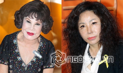 Những ca 'thẩm mỹ hỏng' gây chấn động showbiz châu Á 2014