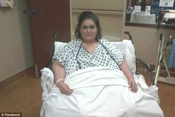 cô gái 453kg phẫu thuật giảm béo 3