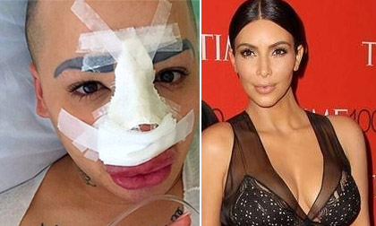 Fan cuồng tiếp tục phẫu thuật mũi để giống Kim Kardashian