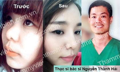 Thạc sĩ bác sĩ Nguyễn Thành Hải: 'Là người mẫu nên có sống mũi thanh tú'
