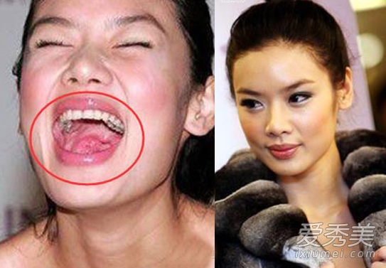 hàm răng kinh dị của sao Hoa ngữ 3