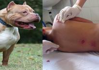 Hà Nội: Chủ nhà và hàng xóm đều nhập viện do bị chó Pitbull tấn công Hà Nội: Chủ nhà và hàng xóm đều nhập viện do bị chó Pitbull tấn công