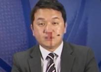 Máu mũi chảy ròng ròng, BTV thể thao vẫn bình tĩnh dẫn chương trình như không có gì xảy ra Máu mũi chảy ròng ròng, BTV thể thao vẫn bình tĩnh dẫn chương trình như không có gì xảy ra