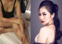 Mối nguy hiểm của căn bệnh ca sĩ Hương Tràm mắc phải Mối nguy hiểm của căn bệnh ca sĩ Hương Tràm mắc phải
