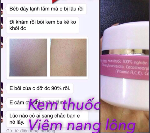 Spa Jollie D, viêm nang lông, Điều trị viêm nang lông, Thẩm mỹ viện điều trị viêm nang lông