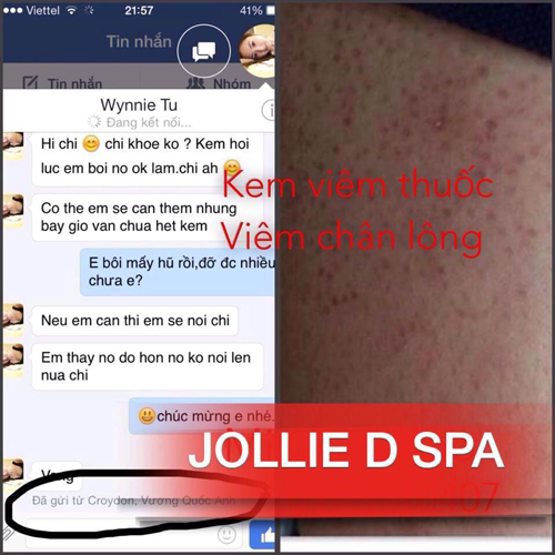 Spa Jollie D, viêm nang lông, Điều trị viêm nang lông, Thẩm mỹ viện điều trị viêm nang lông
