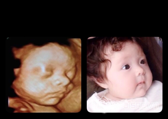 Bạn muốn biết thêm thông tin về quá trình mang thai của Elly Trần? Những hình ảnh chụp siêu âm và các bức ảnh đẹp của cô sẽ giúp bạn có cái nhìn rõ hơn về sự phát triển của thai nhi và cảm nhận được niềm hạnh phúc của người mẹ trong thời kỳ đầy kỳ vọng ấy.