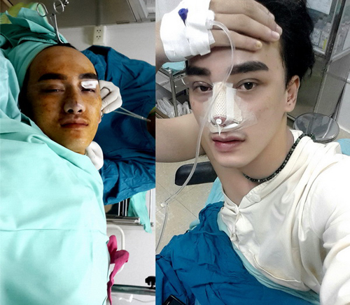 Hà Nhuận Nam, Bệnh viện Thẩm mỹ Hiệp Lợi, Lột xác nhờ phẫu thuật thẩm mỹ