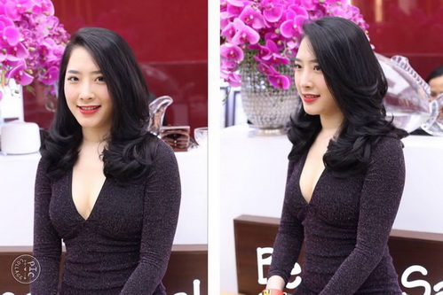 Trị nám, Trị tàn nhang, Thẩm mỹ viện Bích Hoà