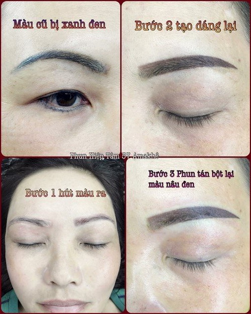 Áo cưới, phun phêu thẩm mỹ Hiệp Tâm, Phun phêu thẩm mỹ Hiệp Tâm, Áo cưới Hiệp Tâm