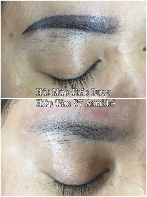 Áo cưới, phun phêu thẩm mỹ Hiệp Tâm, Phun phêu thẩm mỹ Hiệp Tâm, Áo cưới Hiệp Tâm