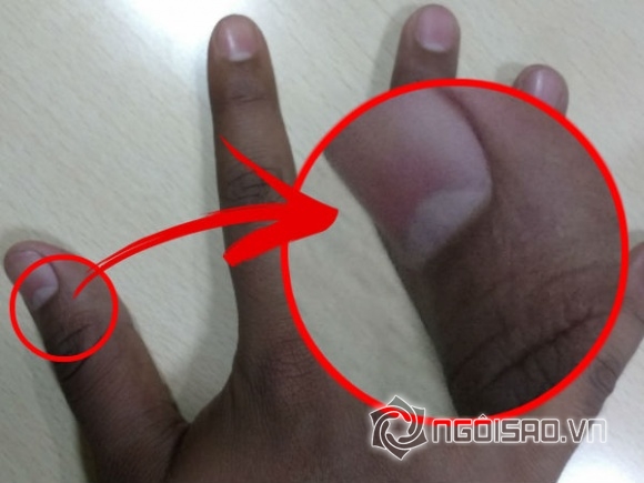 Bói tướng: Nhận biết bệnh tật qua móng tay và vân đầu ngón tay.
