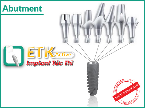 cấy ghép răng ETK Active, Nha Khoa Đông Nam, cấy ghép răng Implant 