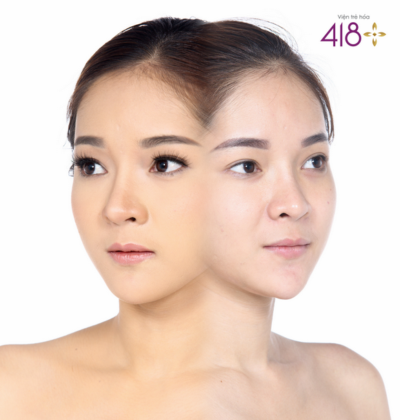 trẻ hoá nội thân, trẻ hóa da, Viện 418+