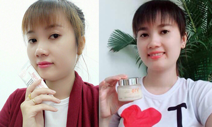 Mỹ phẩm skinaz, mỹ phẩm thiên nhiên, mỹ phẩm hàn quốc