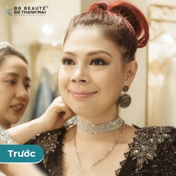 BB Thanh Mai, Trẻ hóa da, MC Thanh Mai