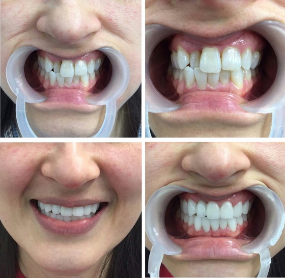 Tấm Dentist, Răng sứ thẩm mỹ, Sức khỏe răng miệng