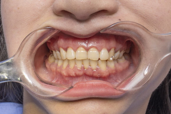 Tấm Dentist, Răng sứ thẩm mỹ, Sức khỏe răng miệng