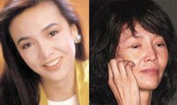 Sao và hậu quả khủng khiếp sau phẫu thuật thẩm mỹ