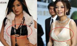 Bóc trần sự thật kiều nữ Cbiz nâng ngực  