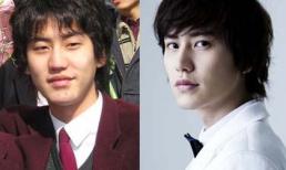 Thành viên Suju thừa nhận phẫu thuật thẩm mỹ 