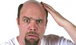 Đầu hói mà nói lung tung