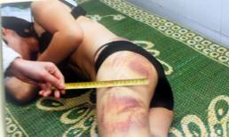 Tạm giam người chồng trong vụ đánh vợ, quay clip