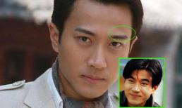  Mỹ nam Hong Kong "lột xác" nhờ dao kéo