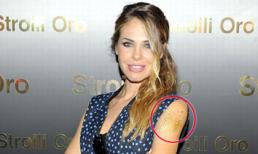 Vợ Totti chơi sang bằng hình xăm... dát vàng