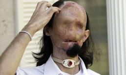 Người đàn ông không có... mặt 