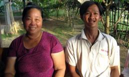 Người đàn ông lột da như... rắn