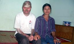 Người mang hình hài tượng phật: Cả đời mang một tiếng đồn!