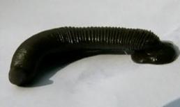 Video: Một thanh niên bị đỉa chui vào cổ họng hút máu