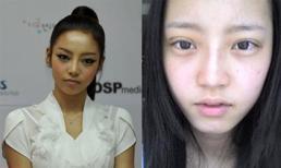 Mắt Goo Hara sưng húp sau phẫu thuật thẩm mỹ