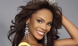 Đến hoa hậu cũng khổ sở vì bị chê... xấu