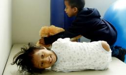 Bé gái "vô chi" lạc quan vui sống