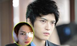 Fans bất ngờ khi Jae Joong (JYJ) phải đeo bông băng trên mắt