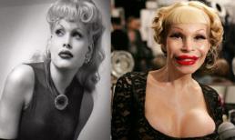 Sao thành 'dị nhân'  sau phẫu thuật thẩm mỹ