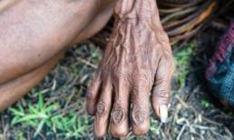 Tập tục cắt cụt ngón tay của bộ tộc Dani ở Indonesia